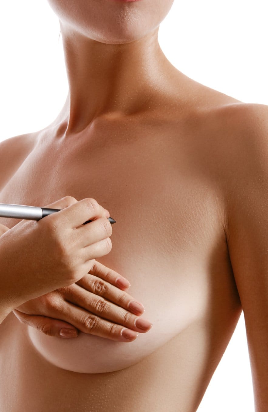 Pexia Mamaria con Implantes